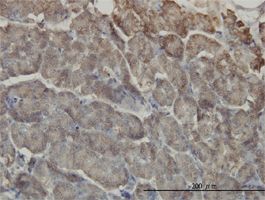 RIP2 antibody (ab57954) used in immunohistochemistry at 3ug/ml on formalin fixed and paraffin embedded human pancreas.