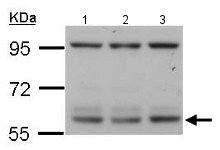 All lanes : Anti-RIP3 antibody (ab152130) at 1/1000 dilutionLane 1 : Mouse B lymphocyte whole cell lysateLane 2 : Mouse thymocyte whole cell lysateLane 3 : Mouse T thymocyte whole cell lysateLysates/proteins at 60 µg per lane.