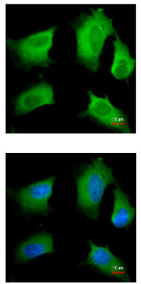 Immunofluorescent analysis of paraformaldehyde-fixed HeLa cells labeling RIP3 with ab152130 at 1/200 dilution. Lower panel merged with DNA probe.