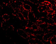 Immunofluorescence of RIP3 in Rat Kidney cells using ab62344 at 20 ug/ml.