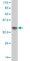 Western blot against tagged recombinant protein immunogen using ab57910 RKHD3 antibody at 1ug/ml.