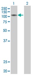 Lane 1 :  Anti-RNF10 antibody (ab67200) at 1/1000 dilutionLane 2 :  Anti-RNF10 antibody (ab67200)Lane 1 : RNF10 transfected lysateLane 2 : Non-transfected lysateLysates/proteins at 25 µg per lane.SecondaryLane 1 : Goat Anti-Mouse IgG (H&L)-HRP conjugated at 1/2500 dilutionLane 2 : Goat Anti-Mouse IgG (H&L)-HRP conjugated at 1/2500 dilution