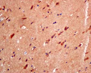 Immunohistochemical analysis of paraffin-embedded Human brain tissue labeling RNF11 with ab154831 at 1/50 dilution.