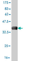 Western blot against tagged recombinant protein immunogen using ab57416 RNF111 antibody at 1ug/ml.
