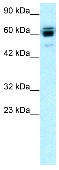 Anti-RNF12 antibody (ab22813) at 1 µg/ml + Jurkat cell lysatedeveloped using the ECL technique
