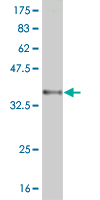 Western blot against tagged recombinant protein immunogen using ab57740 RNF122 antibody at 1ug/ml.