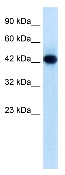 Anti-RNF135 antibody (ab28636) at 0.5 µg/ml + Jurkat cell lysateSecondaryHRP conjugated anti-Rabbit IgGObserved band size : 48 kDa (why is the actual band size different from the predicted?)