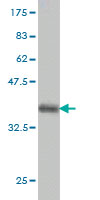 Western blot against tagged recombinant protein immunogen using ab57092 RNF138 antibody at 1ug/ml.