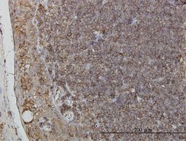RNF139 antibody (ab56924) used in immunohistochemistry at 3ug/ml on formalin fixed and paraffin embedded human tonsil.