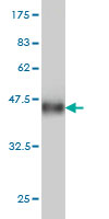 Western blot against tagged recombinant protein immunogen using ab57453 RNF150 antibody at 1ug/ml.