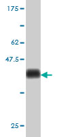 Western blot against tagged recombinant protein immunogen using ab57964 RNF157 antibody at 1ug/ml.