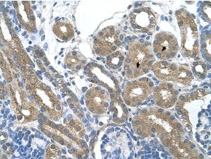 Immunohistochemistry (Formalin/PFA-fixed paraffin-embedded sections) analysis of human kidney tissue labelling RNF165 with ab61284 at 4-8µg/ml. Arrows indicate positively labelled epithelial cells of the renal tubule. Magnification: 400X.
