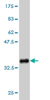 Western blot against tagged recombinant protein immunogen using ab57386 RNF186 antibody at 1ug/ml.