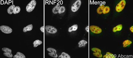 ab70495 (1/1000) detecting RNF20 in HeLa cells (green). Cells were fixed in paraformaldehyde, permeabilised with 0.5% Triton X100/PBS and counterstained with DAPI in order to highlight the nucleus (red). Please refer to Abreview for further experimental details.See Abreview