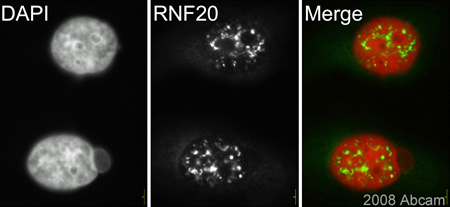 ab33500 (1/500) detecting RNF20 in HeLa cells (green). Cells were fixed with methanol and counterstained with DAPI in order to highlight the nucleus (red). Please refer to abreview for further experimental details.See Abreview