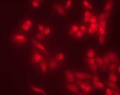 HeLa cells, fixed with 4% paraformaldehyde for 10 minutes. Permeabilized with 0.5% triton X-100 0.5% for 5 minutes. Ab50534 used at a concentration of 10 microgram/ml with 1%BSA for 1 hour.