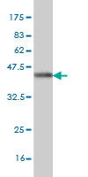 Western blot against tagged recombinant protein immunogen using ab57518 NT5M antibody at 1ug/ml.