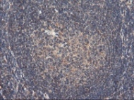 ab119780, at 1/150 dilution, staining RNPEP in paraffin-embedded Human tonsil tissue by Immunohistochemistry.