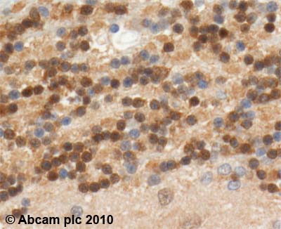 ab2977 (2µg/ml) staining ROC1 in human Brain: Cerebellum using an automated system (DAKO Autostainer Plus). Using this protocol there is cytoplasmic and nuclear staining.Sections were rehydrated and antigen retrieved with the Dako 3-in-1 AR buffer citrate pH 6.0 in a DAKO PT Link. Slides were peroxidase blocked in 3% H2O2 in methanol for 10 minutes. They were then blocked with Dako Protein block for 10 minutes (containing casein 0.25% in PBS) then incubated with primary antibody for 20 minutes and detected with Dako Envision Flex amplification kit for 30 minutes. Colorimetric detection was completed with Diaminobenzidine for 5 minutes. Slides were counterstained with Haematoxylin and coverslipped under DePeX. Please note that, for manual staining, optimization of primary antibody concentration and incubation time is recommended. Signal amplification may be required.