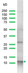 Anti-ROC1 antibody (ab2977) at 1/25 dilution + HeLa cell lysate