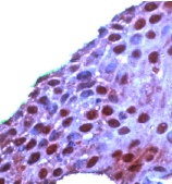 ab15517 staining ROC1 in human tonsil by Immunohistochemistry (FFPE-sections).