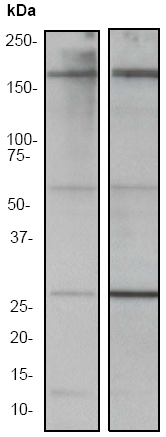 All lanes : Anti-ROCK1 antibody [EP786Y] (ab45171) at 1/500 dilution (unpurified)Lane 1 : Untreated HeLa cell lysateLane 2 : Camptothecin treated HeLa lysate