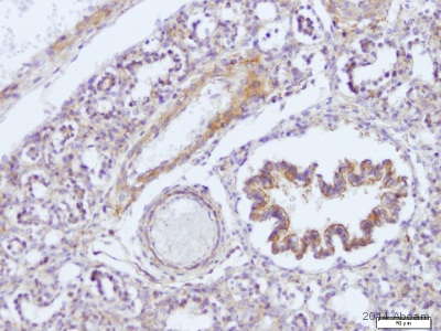 Unpurified ab45171 staining ROCK1 in mouse embyro 18dpc tissue sections by Immunohistochemistry (Formalin/PFA-fixed paraffin-embedded sections). Tissue was fixed with formaldehyde and blocked with 1% FBS/BSA for 2 hours at room temperature; antigen retrieval was by heat mediation in Tris pH 9. Samples were incubated with primary antibody (1/100 in 1% BSA + 1% FBS in TBS) for 16 hours. An undiluted HRP-conjugated goat anti-rabbit IgG polyclonal was used as the secondary antibody.See Abreview