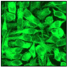 Immunocytochemistry/Immunofluorescence analysis of HeLa cells labelling ROCK1 using unpurified ab45171.