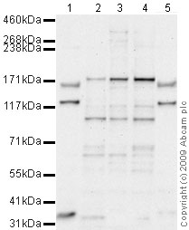 All lanes : Anti-ROCK2 antibody (ab71598) at 1 µg/mlLane 1 : Liver (Mouse) Tissue LysateLane 2 : SK N SH (Human neuroblastoma) Whole Cell LysateLane 3 : U2OS (Human osteosarcoma cell line) Whole Cell LysateLane 4 : HeLa (Human epithelial carcinoma cell line) Whole Cell LysateLane 5 : Liver (Rat) Tissue LysateLysates/proteins at 10 µg per lane.SecondaryGoat polyclonal to Rabbit IgG - H&L - Pre-Adsorbed (HRP) at 1/3000 dilutionPerformed under reducing conditions.