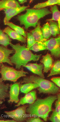 ICC/IF image of ab71598 stained HeLa cells. The cells were 10% neutral buffered formalin fixed (10 min) and then incubated in 1%BSA / 10% normal goat serum / 0.3M glycine in 0.1% PBS-Tween for 1h to permeabilise the cells and block non-specific protein-protein interactions. The cells were then incubated with the antibody (ab71598, 1µg/ml) overnight at +4°C. The secondary antibody (green) was Alexa Fluor® 488 goat anti-rabbit IgG (H+L) used at a 1/1000 dilution for 1h. Alexa Fluor® 594 WGA was used to label plasma membranes (red) at a 1/200 dilution for 1h. DAPI was used to stain the cell nuclei (blue) at a concentration of 1.43µM.