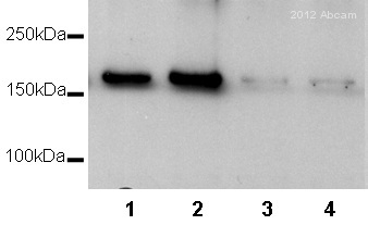 All lanes : Anti-ROCK2 antibody (ab71598) at 1/1000 dilutionLane 1 : Human primary myometrial whole cell lysate with scrambled siRNALane 2 : Human primary myometrial whole cell lysate with scrambled siRNALane 3 : Human primary myometrial whole cell lysate with siRNA against ROCK2Lane 4 : Human primary myometrial whole cell lysate with siRNA against ROCK2Lysates/proteins at 20 µg per lane.SecondaryHRP conjugated Goat anti-rabbit IgG polyclonal at 1/4000 dilutiondeveloped using the ECL techniquePerformed under reducing conditions.