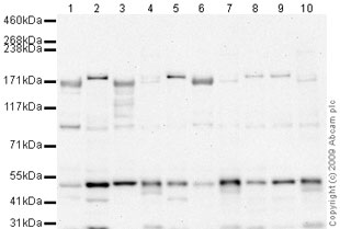 All lanes : Anti-ROCK2 antibody (ab66320) at 1 µg/mlLane 1 : Liver (Mouse) Tissue LysateLane 2 : SK N BE (Human neuroblastoma) Whole Cell LysateLane 3 : Liver (Human) Tissue Lysate - adult normal tissue (ab29889)Lane 4 : HeLa Whole Cell Lysate - Hydroxyurea Treated (48hr, 2uM)Lane 5 : Y79 (Human retinoblastoma cell line) Whole Cell LysateLane 6 : Liver (Rat) Tissue LysateLane 7 : HeLa Whole Cell Lysate - Staurosporine Treated (24hr, 500nM)Lane 8 : Raji (Human Burkitt's lymphoma cell line) Whole Cell LysateLane 9 : Jurkat Whole Cell Lysate - Staurosporine Treated (24hr, 500nM)Lane 10 : HeLa Whole Cell Lysate - Bleomycin Treated (20U/ml)Lysates/proteins at 10 µg per lane.SecondaryGoat polyclonal to Rabbit IgG - H&L - Pre-Adsorbed (HRP) at 1/3000 dilutionPerformed under reducing conditions.