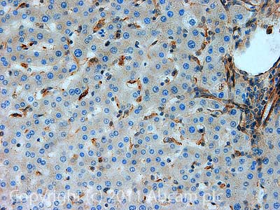 IHC image of ab66320 staining ROCK2 in Human liver formalin fixed paraffin embedded tissue section, performed on a Leica BondTM system using the standard protocol F. The section was pre-treated using heat mediated antigen retrieval with sodium citrate buffer (pH6, epitope retrieval solution 1) for 20 mins. The section was then incubated with ab66320, 5µg/ml, for 15 mins at room temperature and detected using an HRP conjugated compact polymer system. DAB was used as the chromogen. The section was then counterstained with haematoxylin and mounted with DPX.For other IHC staining systems (automated and non-automated) customers should optimize variable parameters such as antigen retrieval conditions, primary antibody concentration and antibody incubation times.