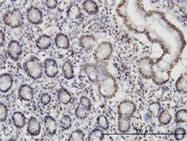 ROD1 antibody (ab56918) used in immunohistochemistry at 3ug/ml on formalin fixed and paraffin embedded human small Intestine.