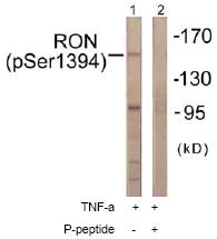 All lanes : Anti-RON (phospho S1394) antibody (ab61007) at 1/500 dilutionLane 1 : extracts from HeLa cells, treated with TNF-a (20ng/ml, 2mins)Lane 2 : extracts from HeLa cells, treated with TNF-a (20ng/ml, 2mins) with immunizing phosphopeptide