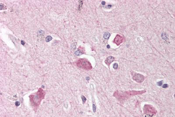 Immunohistochemical analysis of formalin-fixed, paraffin-embedded Human brain, cortex tissue labeling Nicastrin with ab189160 at 10 µg/ml, followed by biotinylated secondary antibody, alkaline phosphatase-streptavidin and chromogen.