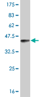 Western blot against tagged recombinant protein immunogen using ab58312 ROR beta antibody at 1ug/ml.