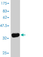 Western blot against tagged recombinant protein immunogen using ab55765 ROR1 antibody at 1ug/ml.