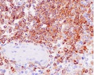 Immunohistochemical analysis of paraffin-embedded human spleen tissue labeling RP105 with ab184956 at 1/500 dilution and HRP Polymer to Rabbit IgG. Counterstained with Hematoxylin.