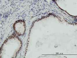 RPA14 antibody (ab58317) used in immunohistochemistry at 3ug/ml on formalin fixed and paraffin embedded human prostate.