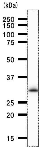 Anti-RPA32/RPA2 antibody [2927C5] (ab51499) at 1/200 dilution + HeLa whole cell lysate at 25 µgSecondaryAnti Mouse IgG at 1/2500 dilution