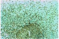 ab2175 - immunohistochemistryFormalin fixed paraffin embedded human tonsil stained with RPA using ABC and AEC chromogen.