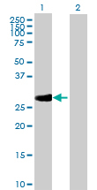 All lanes : Anti-RPA4 antibody (ab169032) at 1 µg/mlLane 1 : RPA4-transfected 293T cell line lysateLane 2 : Non-transfected 293T cell line lysateSecondaryGoat Anti-Mouse IgG (H&L)-HRP at 1/2500 dilutiondeveloped using the ECL technique