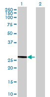 All lanes : Anti-RPIA antibody (ab67080) at 1/500 dilutionLane 1 : RPIA transfected 293T cell lysateLane 2 : Non-transfected 293T cell lysateLysates/proteins at 25 µg/ml per lane.SecondaryGoat Anti-Mouse IgG (H&L)-HRP Conjugate at 1/2500 dilution