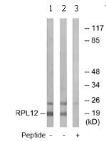 All lanes : Anti-RPL12 antibody (ab74714) at 1/500 dilutionLane 1 : extracts from HepG2 cellsLane 2 : extracts from HeLa cellsLane 3 : extracts from HepG2 cells with immunising peptide at 10 µgLysates/proteins at 30 µg per lane.