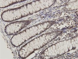 RPL14 antibody (ab56388) used in immunohistochemistry at 3ug/ml on formalin fixed and paraffin embedded human colon.