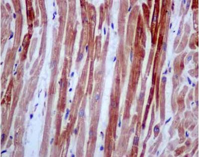 Immunohistochemical analysis of paraffin-embedded Human heart muscle tissue labeling RPL14 with ab181200 at 1/250 dilution followed by pre-diluted HRP-conjugated secondary antibody and counter-stained with Hematoxylin.