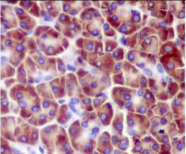Immunohistochemical analysis of paraffin-embedded Human cardiac muscle tissue labeling RPL14 with ab181200 at 1/250 dilution followed by pre-diluted HRP-conjugated secondary antibody and counter-stained with Hematoxylin.