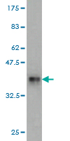 Western blot against tagged recombinant protein immunogen using ab58325 RPL18 antibody at 1ug/ml.
