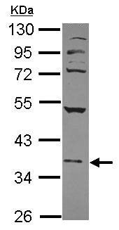 Anti-Nuclear Factor Erythroid Derived 2 antibody (ab154605) at 1/1000 dilution + 293T whole cell lysate at 30 µg